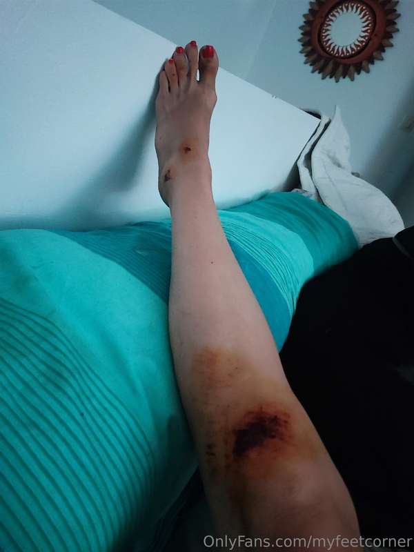 It' s not Nice when you are a foot model, you are alone in a..
