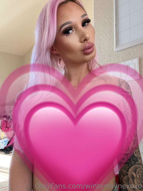 Post OP day 10!!! Showing off my new XL overfilled implants ..
