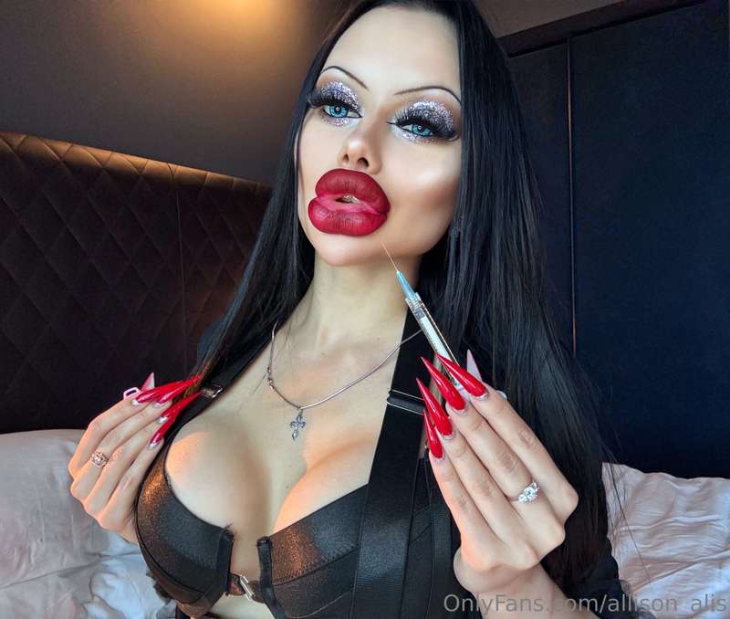 Never enough with lips augmentation 🫦
