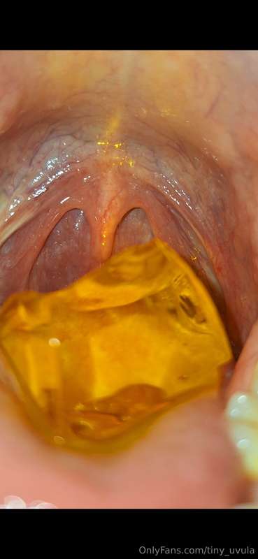 Something special...special light show inside my mouth. Look..