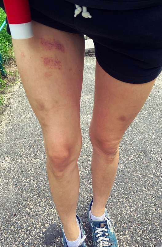 I love showing off my marks after a session 🥰