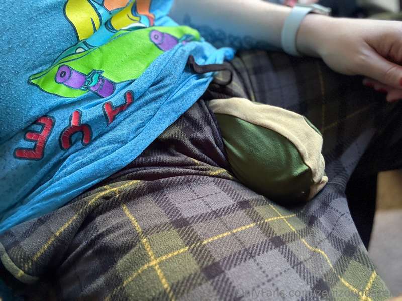 This is what I looked like the next afternoon from my infusi..